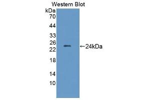 Detection of Recombinant LAMb2, Rat using Polyclonal Antibody to Laminin Beta 2 (LAMb2) (LAMB2 antibody  (AA 939-1129))