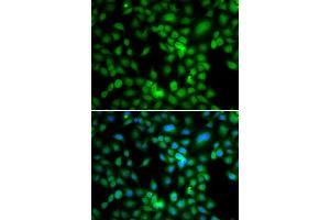 Immunofluorescence analysis of MCF7 cell using SYCE1 antibody. (SYCE1 antibody)