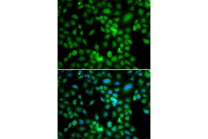 Immunofluorescence analysis of MCF7 cell using SYCE1 antibody.