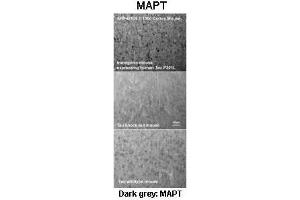 Immunohistochemistry (IHC) image for anti-Microtubule-Associated Protein tau (MAPT) (Middle Region) antibody (ABIN2783223)
