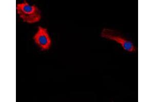 Immunofluorescent analysis of Gastrin staining in HeLa cells. (Gastrin antibody  (Center))