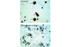 Sample type -- oral cell carcinoma Dilution -- 5ug/mL (Adenosine A2a Receptor antibody  (C-Term))