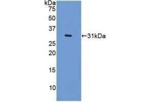 Detection of Recombinant CENPI, Human using Polyclonal Antibody to Centromere Protein I (CENPI) (CENPI antibody  (AA 292-528))