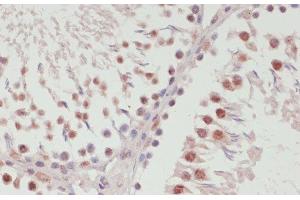 Immunohistochemistry of paraffin-embedded Rat testis using SNRNP70 Polyclonal Antibody at dilution of 1:100 (40x lens).