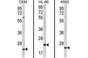 Western blot analysis of KLRC2 Antibody (N-term) from left to right in CEM, HL-60, K562 cell line lysates (35ug/lane).
