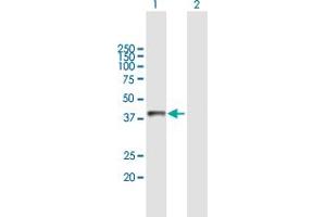 Western Blot analysis of ASGR2 expression in transfected 293T cell line by ASGR2 MaxPab polyclonal antibody. (Asialoglycoprotein Receptor 2 antibody  (AA 1-287))