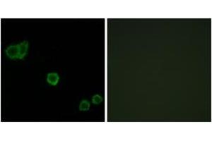 Immunofluorescence analysis of HeLa cells, using CPI17 alpha (Ab-38) Antibody. (CPI-17 antibody  (AA 5-54))