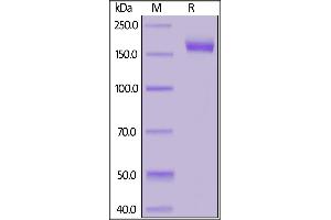 SDS-PAGE (SDS) image for SARS-CoV-2 Spike (Super Stable Trimer) protein (His tag) (ABIN6953302)