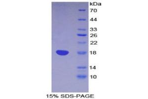 SDS-PAGE (SDS) image for Lymphocyte Antigen 96 (LY96) (AA 16-160) protein (His tag) (ABIN1170883) (LY96 Protein (AA 16-160) (His tag))