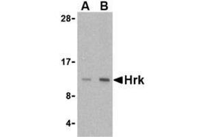 Western blot analysis of Hrk in mouse pancreas tissue lysate with AP30395PU-N Hrk antibody at (A) 2. (HRK antibody  (Center))