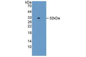 Western blot analysis of recombinant Rat IL17RD. (IL17RD antibody  (AA 356-605))