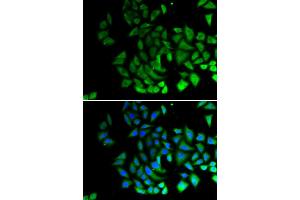 Immunofluorescence analysis of U2OS cell using MIWI antibody.