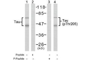Image no. 2 for anti-Microtubule-Associated Protein tau (MAPT) (pThr205) antibody (ABIN196803) (MAPT antibody  (pThr205))
