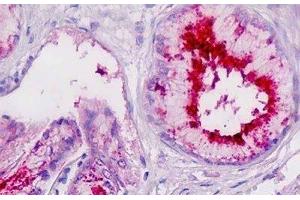 Human Pancreatic Duct: Formalin-Fixed, Paraffin-Embedded (FFPE) (PLA2G7 antibody)