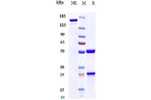 Anti-Mesothelin Reference Antibody (amatuximab) on SDS-PAGE under reducing (R) condition. (Recombinant Mesothelin (Amatuximab Biosimilar) antibody)