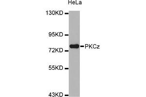 Western blot analysis of extracts of HeLa cells, using PRKCZ antibody (ABIN5973342). (PKC zeta antibody)