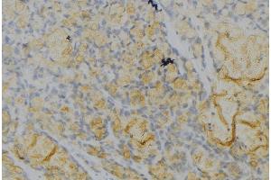 ABIN6277107 at 1/100 staining Human gastric tissue by IHC-P. (Thrombospondin 1 antibody  (Internal Region))