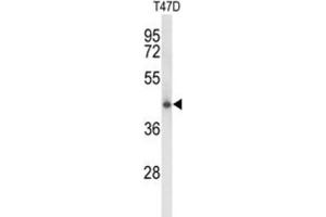 Western Blotting (WB) image for anti-Ceroid-Lipofuscinosis, Neuronal 5 (CLN5) antibody (ABIN3003962)
