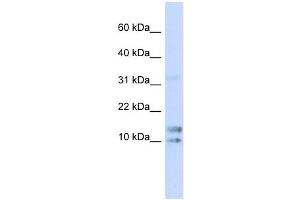 IL15 antibody used at 1 ug/ml to detect target protein. (IL-15 antibody  (N-Term))