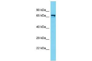 anti-Zinc Finger, CW Type with PWWP Domain 1 (ZCWPW1) (N-Term) antibody