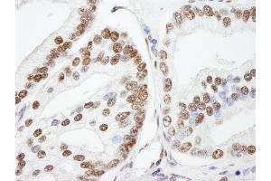 Immunohistochemistry (IHC) image for anti-Nuclear Casein Kinase and Cyclin-Dependent Kinase Substrate 1 (NUCKS1) (AA 1-50) antibody (ABIN7448993)