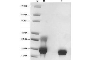 5 μg of IL-4, Human was resolved with SDS-PAGE under reducing (R) and non-reducing (N) conditions and visualized by Coomassie Blue staining. (IL-4 Protein (AA 25-153))