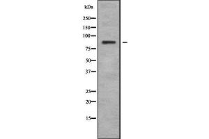 Western Blotting (WB) image for anti-Leucine Rich Repeat and Sterile alpha Motif Containing 1 (LRSAM1) (Internal Region) antibody (ABIN6263013)