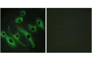Immunofluorescence analysis of HeLa cells, using HER2 Antibody.