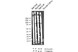 Western blot analysis of Phospho-STAT6 (Tyr641) expression in various lysates