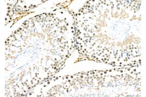 ABIN6258098 and ABIN6273477 at 1/100 staining Rat testis tissue by IHC-P.