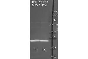 Goat anti antibody  was used to detect purified Beta Phospho Glucomutase under reducing (R) and non-reducing (NR) conditions. (Beta-Phosphoglucomutase antibody  (Biotin))