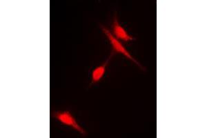 Immunofluorescent analysis of Histone Deacetylase 6 (pS22) staining in Hela cells. (HDAC6 antibody  (N-Term, pSer22))