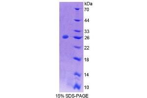 SDS-PAGE (SDS) image for Protein tyrosine Phosphatase, Non-Receptor Type 21 (PTPN21) (AA 983-1176) protein (His tag) (ABIN4989876) (PTPN21 Protein (AA 983-1176) (His tag))