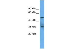 Western Blotting (WB) image for anti-Adenylate Cyclase Activating Polypeptide 1 (Pituitary) Receptor Type I (ADCYAP1R1) (C-Term) antibody (ABIN2788270)