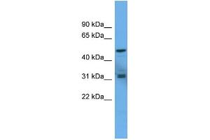 WB Suggested Anti-ADCYAP1R1 Antibody Titration: 0. (ADCYAP1R1 antibody  (C-Term))