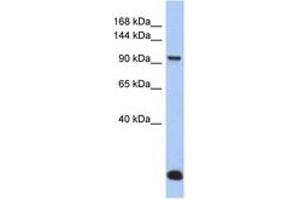 Image no. 1 for anti-Major Vault Protein (MVP) (N-Term) antibody (ABIN6744297) (MVP antibody  (N-Term))