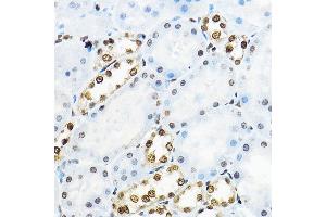 Immunohistochemistry of paraffin-embedded rat kidney using NR5 Rabbit pAb (ABIN6127421, ABIN6144833, ABIN6144835 and ABIN6221444) at dilution of 1:100 (40x lens). (NR5A2 + LRH1 antibody  (AA 206-495))