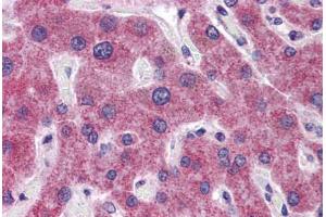 Human Liver: Formalin-Fixed, Paraffin-Embedded (FFPE) (RHBG antibody  (AA 362-411))