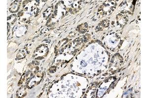 anti-Stabilin 2 (STAB2) antibody