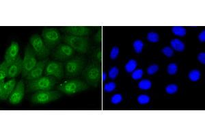 HepG2 cells were stained with Smad5(S463/465) (1B8) Monoclonal Antibody  at [1:200] incubated overnight at 4C, followed by secondary antibody incubation, DAPI staining of the nuclei and detection. (SMAD5 antibody  (pSer463, pSer465))