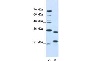 Western Blotting (WB) image for anti-AlkB, Alkylation Repair Homolog 8 (ALKBH8) antibody (ABIN2462330)