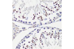 Immunohistochemistry of paraffin-embedded rat testis using HFM1 antibody (ABIN6133318, ABIN6141741, ABIN6141743 and ABIN6224711) at dilution of 1:100 (40x lens). (HFM1 antibody  (AA 1-240))