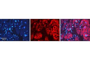 Immunohistochemistry (IHC) image for anti-Apoptosis-Inducing Factor, Mitochondrion-Associated, 1 (AIFM1) (C-Term) antibody (ABIN2778665)