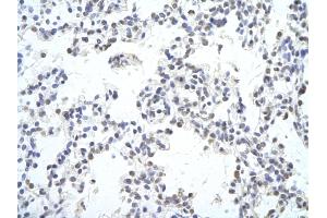 Rabbit Anti-MAF Antibody Catalog Number: ARP38608_P050  Paraffin Embedded Tissue: Human Lung cell  Cellular Data: Epithelial cells of renal tubule Antibody Concentration:  4.