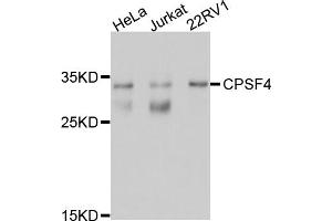 Western blot analysis of extracts of various cell lines, using CPSF4 antibody (ABIN5997508) at 1/1000 dilution. (CPSF4 antibody)