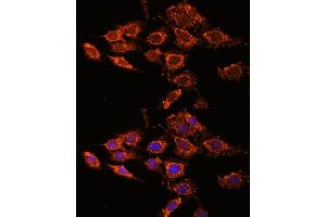 Immunofluorescence analysis of C6 cells using PASK antibody (ABIN6128413, ABIN6145248, ABIN6145249 and ABIN6224850) at dilution of 1:100.