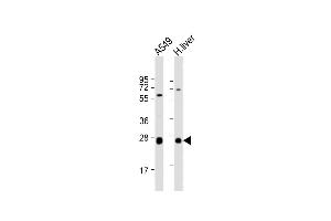 All lanes : Anti-TRH Antibody (C-Term) at 1:2000 dilution Lane 1: A549 whole cell lysate Lane 2: human liver lysate Lysates/proteins at 20 μg per lane. (TRH antibody  (AA 157-191))