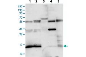Western blot analysis of Lane 1: RT-4, Lane 2: U-251 MG, Lane 3: Human Plasma, Lane 4: Liver, Lane 5: Tonsil with FAM103A1 polyclonal antibody  at 1:250-1:500 dilution.