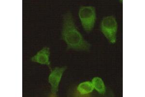 Immunocytochemistry staining of Hela using Eg5 mouse mAb (1:200). (KIF11 antibody)