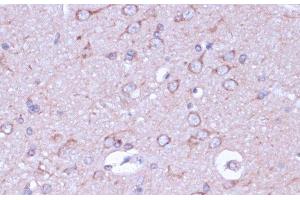 Immunohistochemistry of paraffin-embedded Rat brain using PRKACB Polyclonal Antibody at dilution of 1:100 (40x lens). (PRKACB antibody)